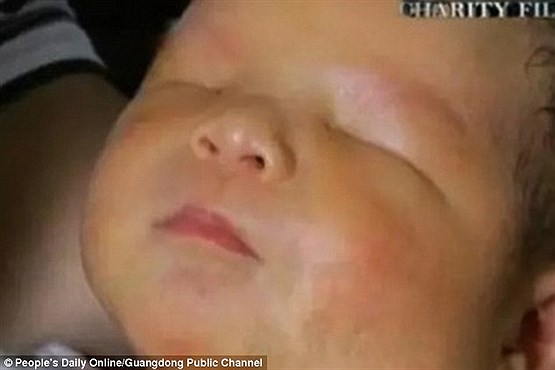 کودک عجیب عجیب الخلقه زندگی در چین تولد نوزاد عجیب بیماری عجیب اخبار چین آنوفتالمی