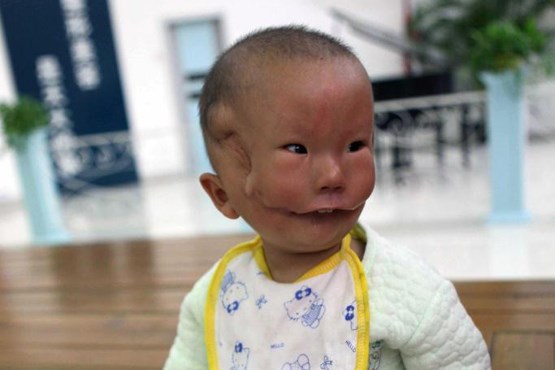 عجیب الخلقه بیماری مادرزادی انسان عجیب اخبار چین