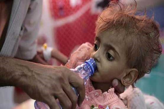 ۱۲ میلیون کودک یمنی نیازمند کمک فوری