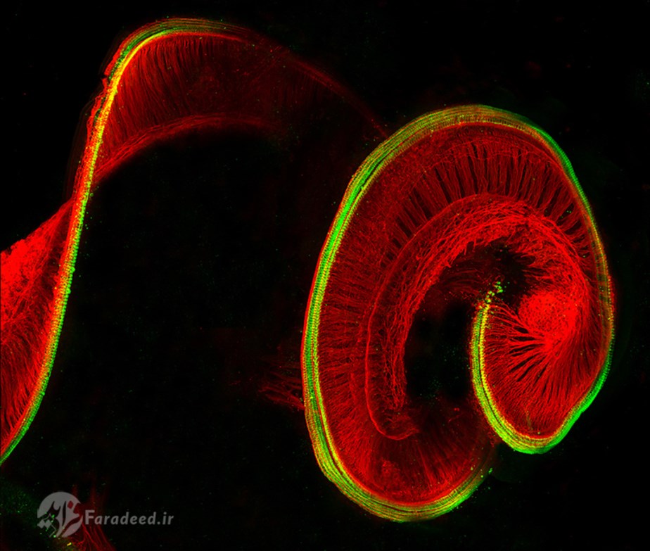 عکس‌های میکروسکوپی عجیب و باورنکردنی